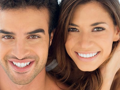 Dental Bonding La Jolla