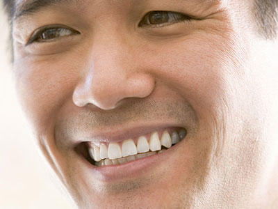 Root Canal La Jolla